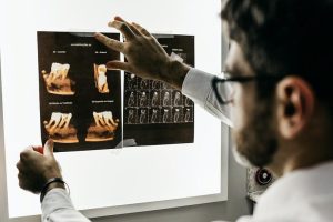 Doctor analysing x-ray